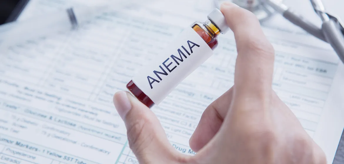 Iron Deficiency Anemia ICD-10