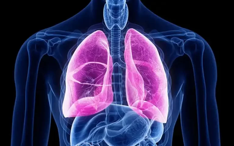 Chronic Obstructive Pulmonary Disease